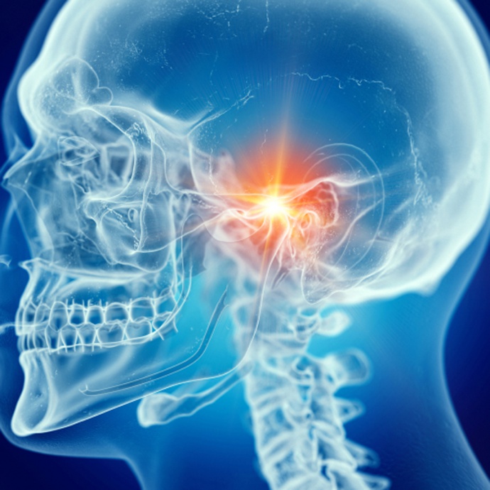 Temporo-mandibulaire dysfuncties